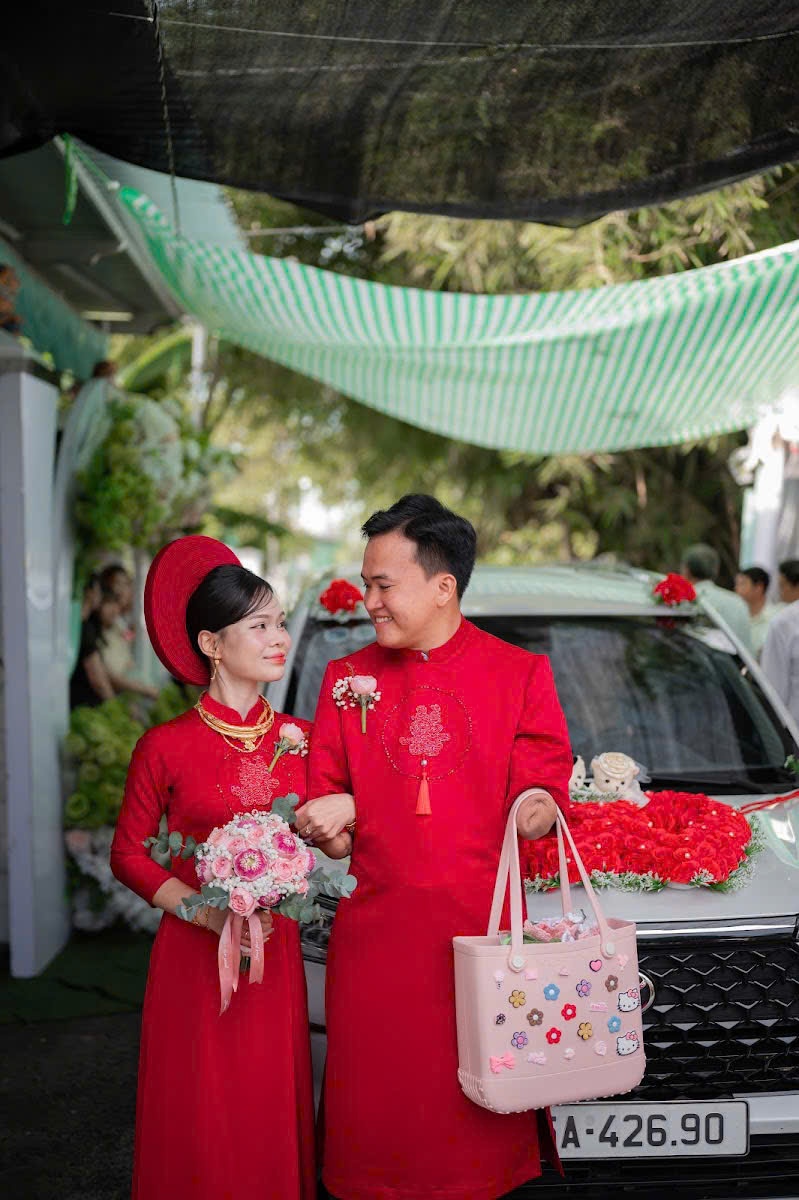 mất hai tay ảnh 2 mất hai tay ảnh 2