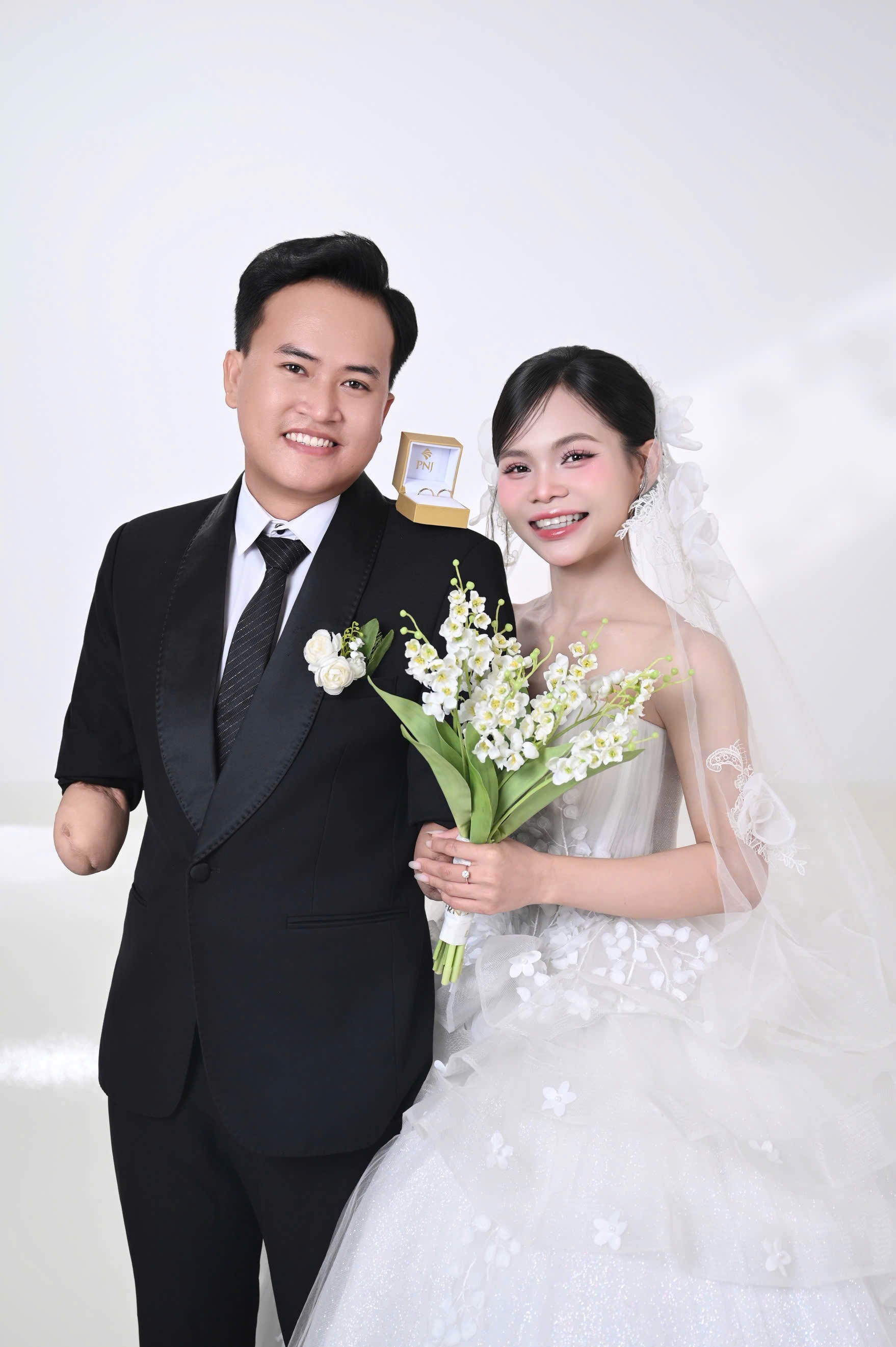 mất hai tay ảnh 3 mất hai tay ảnh 3
