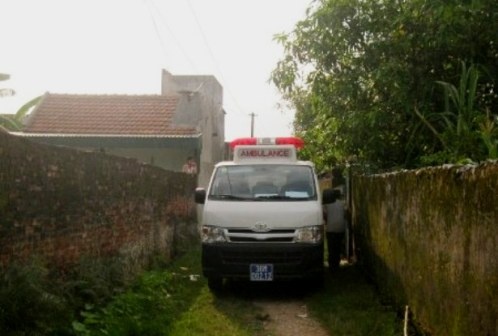 Mo thai luu, thai phu tu vong bat thuong hinh anh