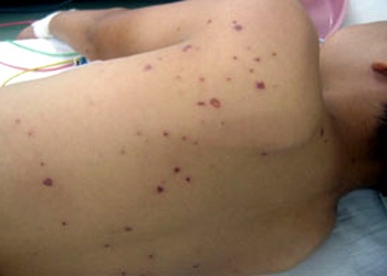 Cuu be trai 7 tuoi bi ong vo ve dot toan than hinh anh