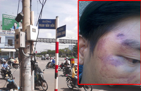 Co dong ke chuyen dua nguoi nghi bi cong an danh di cap cuu hinh anh