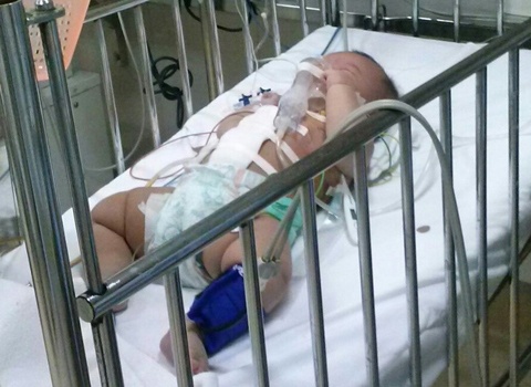 Be gai 4 thang tuoi bi bo dam thung bung hinh anh