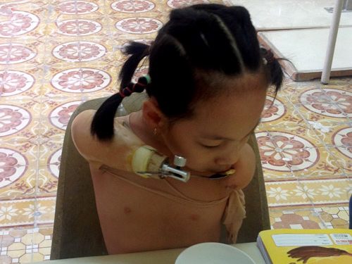 Lap tay gia cho Nick Vujicic cua Viet Nam hinh anh