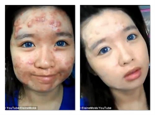 Thu thuat trang diem cua co nang mat day mun hinh anh