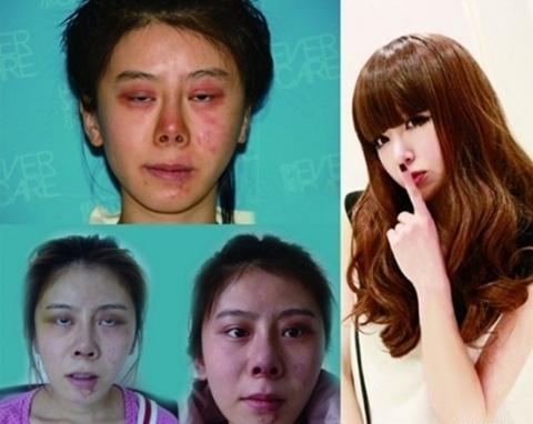 Co gai dang xinh hoa xau te vi 9 lan phau thuat hinh anh