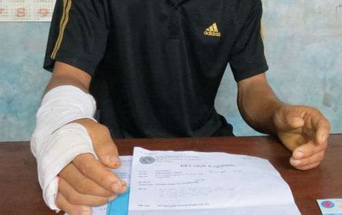 Vo xuong thuyen tay phai, bo bot tay trai hinh anh