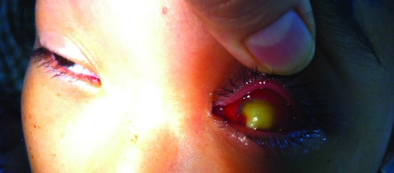 Dap la dam but, hoc sinh 13 tuoi phai bo mat hinh anh