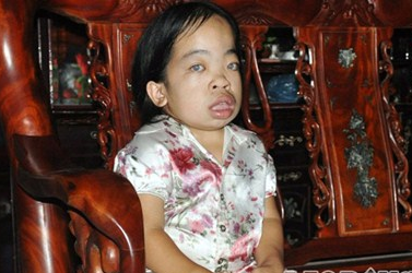 Co gai 18 tuoi trong hinh hai tre len 5 hinh anh