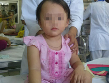 Be gai 3 tuoi cap cuu vi uong nham dau hoa hinh anh