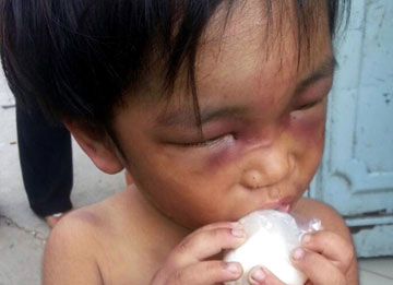 Be trai bi tra tan: Hanh vi tan ac cua nguoi cau hinh anh