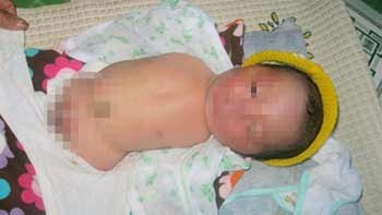 Mot be trai moi sinh khong co tay chan hinh anh