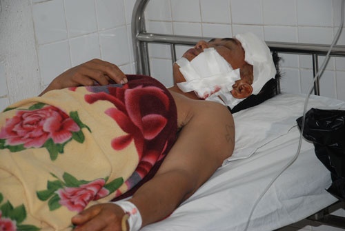 Vu xa beng dam xuyen dau: Phut sinh tu qua loi ke hinh anh