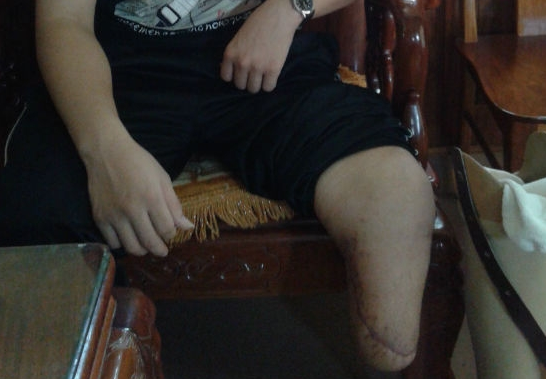 Mat oan mot chan khi dieu tri o phong kham tu hinh anh