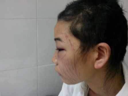 Chong bat vo tu cat toc, rach mat vi... tin nhan la hinh anh