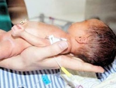 Be bi gay tay, chan khi mo sinh da qua doi hinh anh