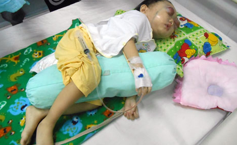 Roi le truoc chau be co doi mat phong to hinh anh