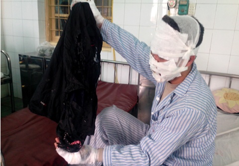 Bong bay phat no, ca nha bi chay khap mat hinh anh