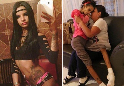 Co gai xinh dep bi bien dang sau phau thuat nang nguc hinh anh