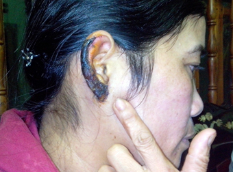 Chi chong can nat tai em dau hinh anh