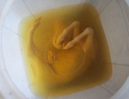 Bi, hai ruou ngam bao thai ngua hinh anh