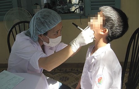 Han che giam nguoi chua thanh nien hinh anh