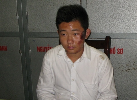 Bao ve Khanh va lan duy nhat mo thay chi Huyen hinh anh