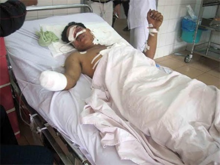 Dau dan no, em be 2 tuoi va cha bi thuong nang hinh anh