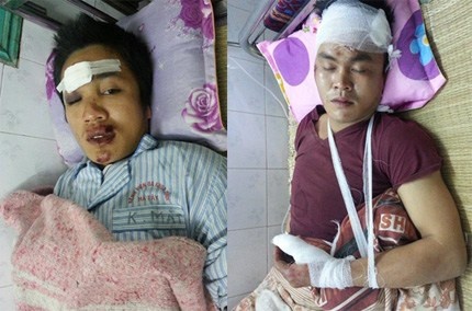 Tai xe gay tai nan voi 3 nguoi, dua di vien roi bo tron hinh anh