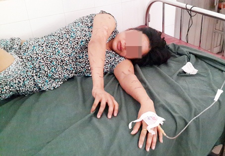 Mot phu nu bi tra tan nhu thoi trung co o Dong Nai hinh anh