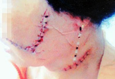 Doi chi phi tai tao do bi… rach mat hinh anh