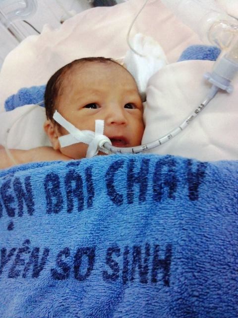 Sau khi mổ, bé Trí Dũng đã qua cơn nguy kịch.