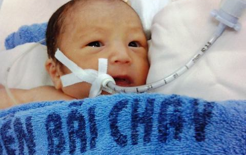 Be trai chan thuong so nao bi vut ben duong hinh anh