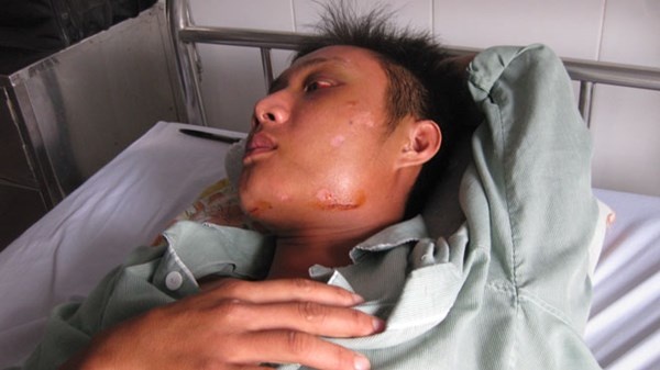 Co dau hieu de lot toi voi trum giang ho Dung 'Phuong' hinh anh