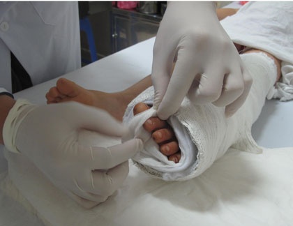 Be gai bi tam chan bo xe may cat dut ban chan hinh anh