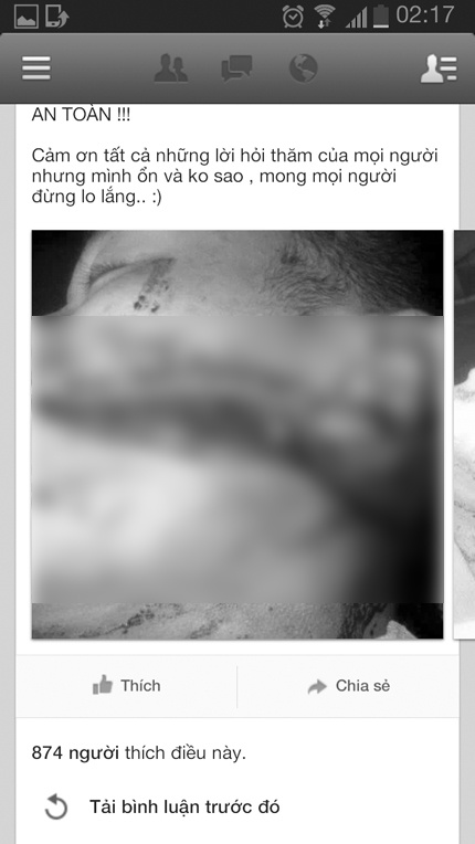 Trên trang facebook cá nhân, nạn nhân Q đã chia sẻ thông tinvề vụ rạch mặt xảy ra với mình.