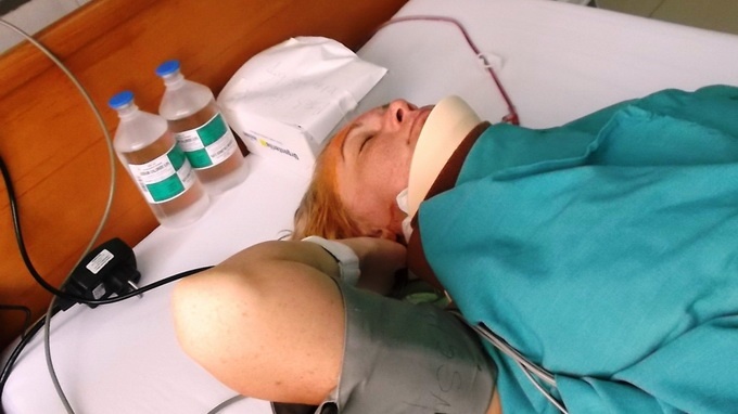 Nu du khach chan thuong cot song co vi ca du tan cong hinh anh