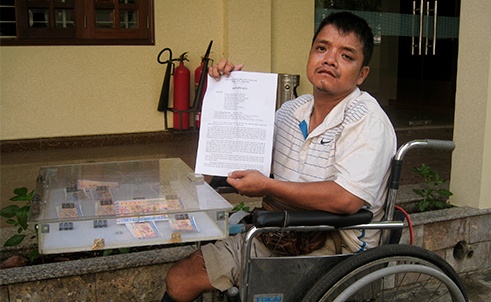 Cut hai chan van phai bo len lau 6 vi quy dinh chung cu hinh anh