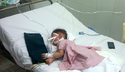 Tu vong do soi cao gap 6 lan trong 10 nam qua hinh anh