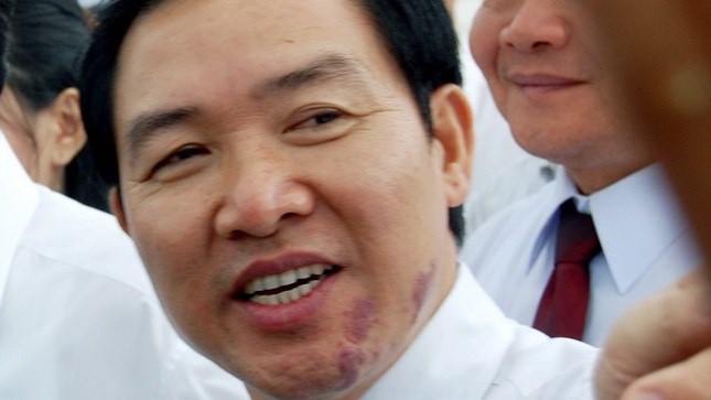 Doi dien an tu, Duong Chi Dung van 'si tinh' hinh anh