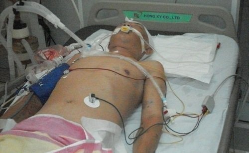 Phai di cap cuu sau khi roi tru so cong an hinh anh