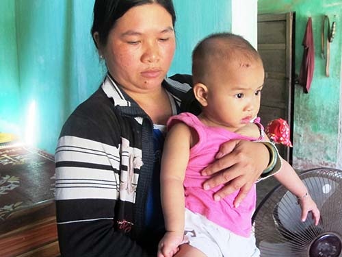 Do nguoc khi sinh, be gai liet tay hinh anh