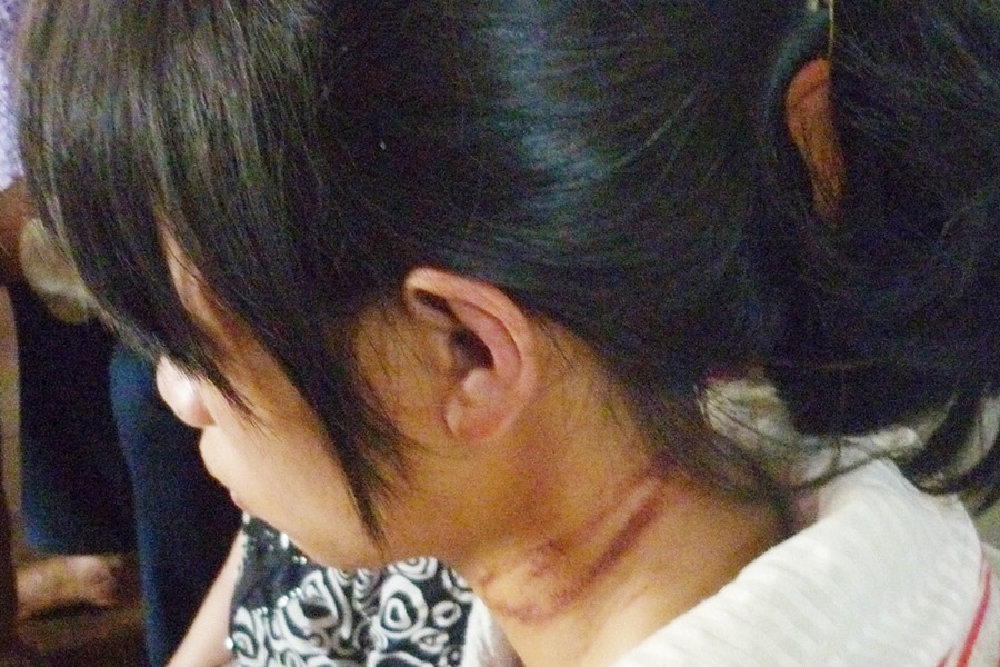 Bi me ruot hanh ha da man, thieu nu uong thuoc tu tu hinh anh