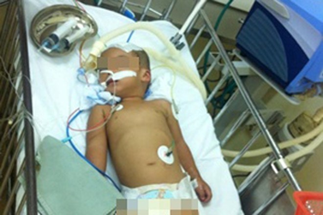 Nga tu ban cong 5 met, be 3 tuoi chan thuong so nao hinh anh