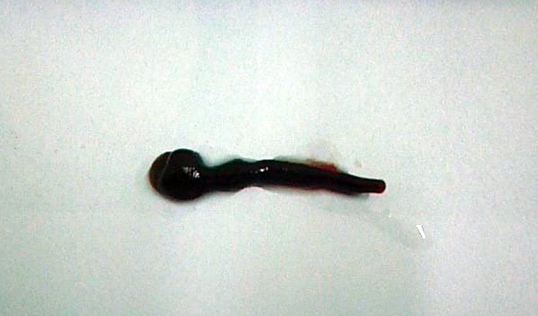 Con sen dai 3 cm chui vao mui em be hinh anh