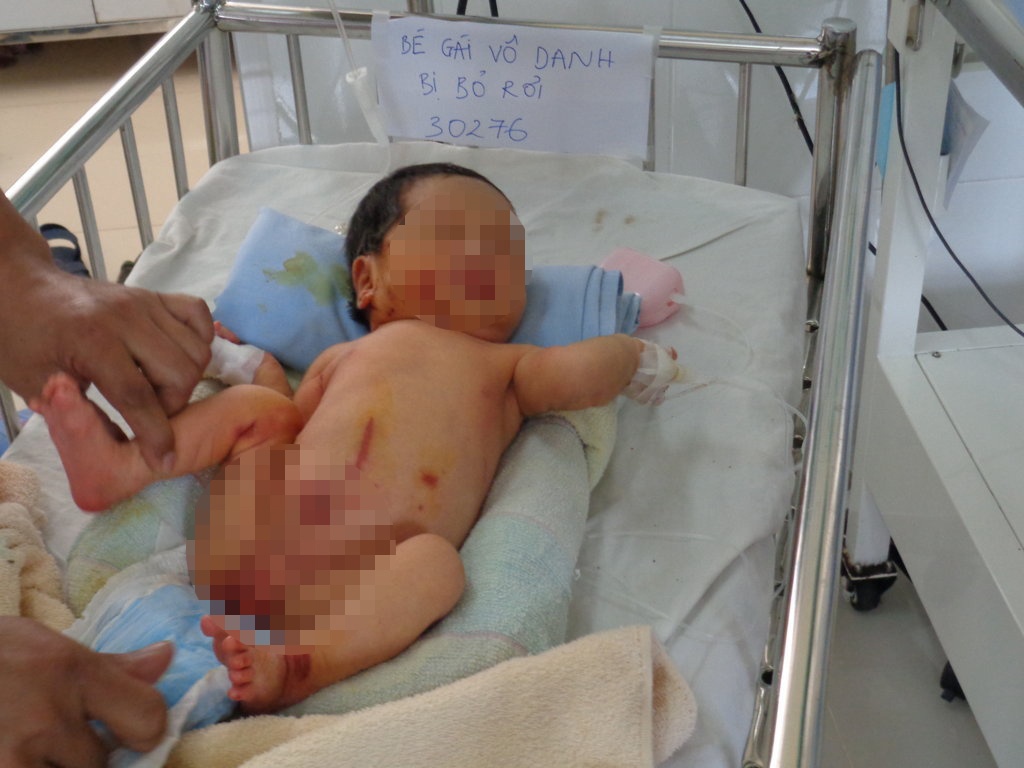 Be gai so sinh bi bo roi o bui tre, tren nguoi bam day doi hinh anh