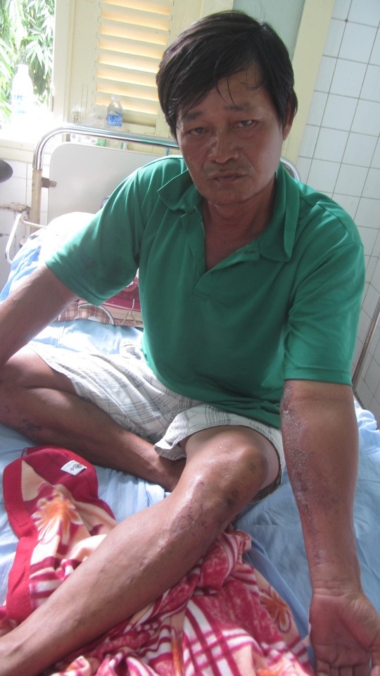 Thuyền viên Nguyễn Thành Lâm cố gắng đeo bám nên bị trầy xước nặng, 3 người trong nhóm của ông bị đuối sức, đã buông tay.