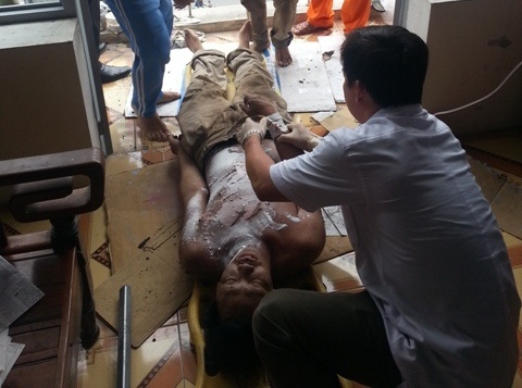 Mot nguoi dan ong bi dien giat chay sem hinh anh