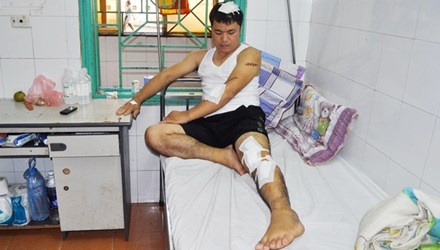 Di lam ve khuya, quan ly karaoke hung tron 'mua dao' hinh anh