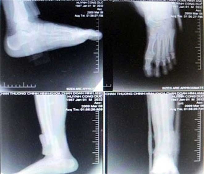 Hanh trinh 'an' phim tai benh vien chan thuong chinh hinh hinh anh