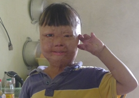 Cuoc song cua chau be bi cha dot 3 nam truoc hinh anh